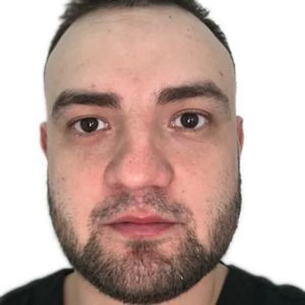 Гареев Фидан Ринатович — Стоматолог-хирург, Уфа