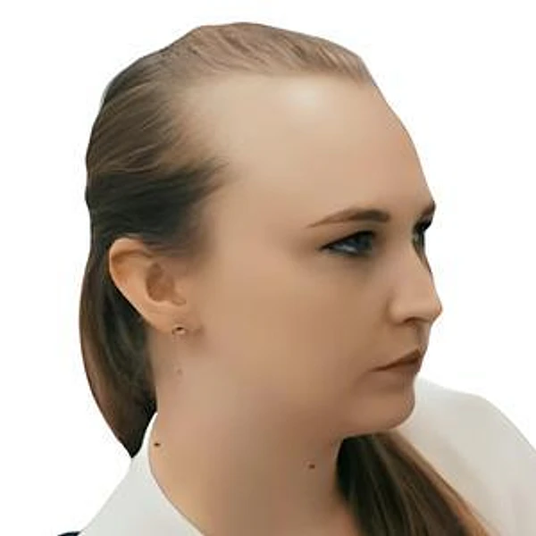 Биева Анна Васильевна — Гинеколог, Акушер, Гинеколог-хирург, Екатеринбург