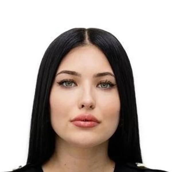 Вальковская Алина Игоревна — Врач-косметолог, Дерматолог, Трихолог, Волжский
