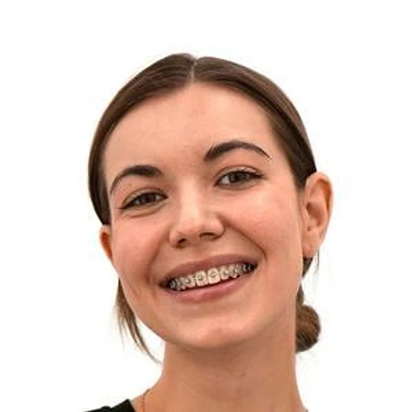 Дейнега Анастасия Николаевна — Стоматолог-ортодонт, Детский ортодонт, Екатеринбург