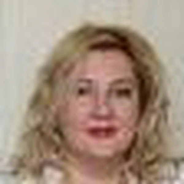 Орлова Ирина Владимировна — Дерматолог, Венеролог, Ростов-на-Дону