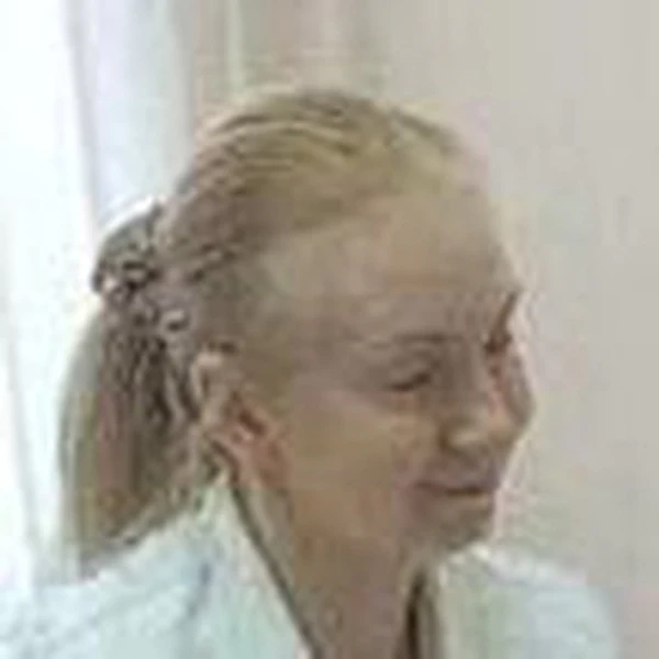 Шишлова Лариса Валентиновна — Дерматолог, Венеролог, Трихолог, Химки
