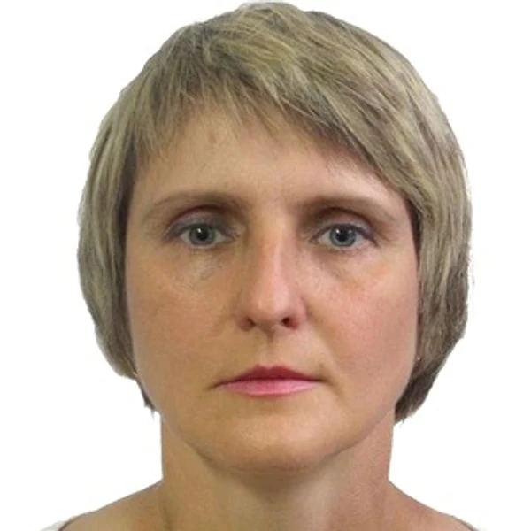Аюпова Светлана Анатольевна — Стоматолог, Стоматолог-ортопед, Самара