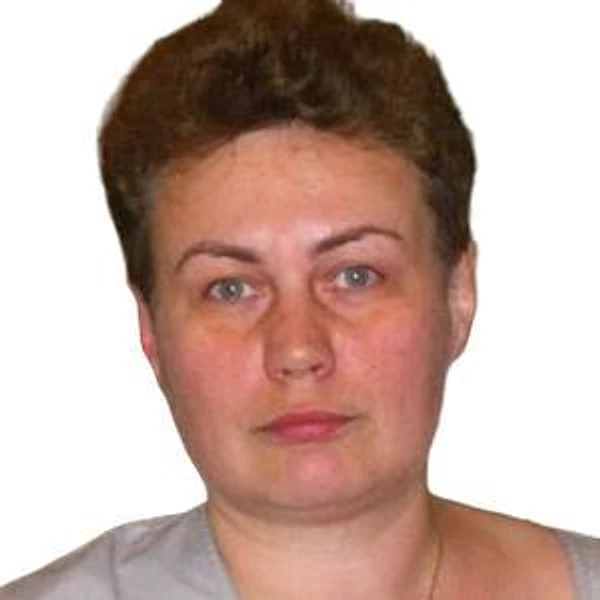 Беляева Светлана Викторовна — Стоматолог-хирург, Череповец