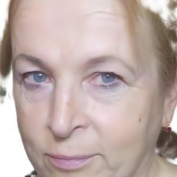 Калашникова Елена Алексеевна — ЛОР, Кострома