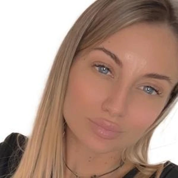 Кобзева Валерия Сергеевна — Дерматолог, Детский дерматолог, Детский трихолог, Трихолог, Нижневартовск