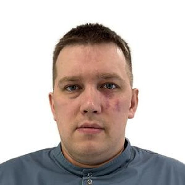 Султанов Артур Ирекович — Стоматолог, Стоматолог-ортопед, Уфа