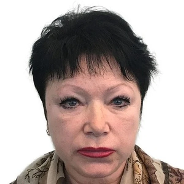 Ветошкина Елена Ивановна — Рентгенолог, Санкт-Петербург