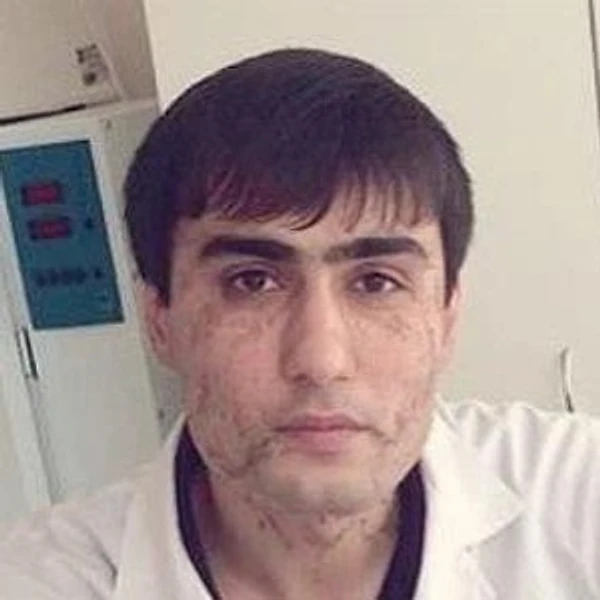 Алиев Ильхам Джафарович — Уролог, Нальчик
