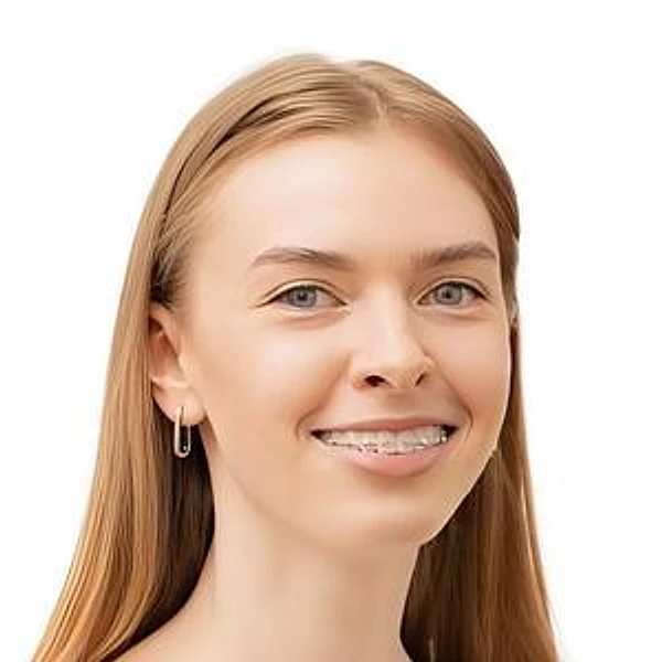 Аксенова Мария Олеговна — Стоматолог-ортодонт, Детский ортодонт, Ярославль