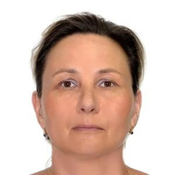Богачева Екатерина Александровна — Стоматолог-хирург, Стоматолог, Гатчина